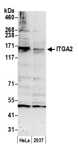 ITGA2/CD49B/Integrin alpha-2 Antibody in Western Blot (WB)