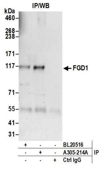 FGD1 Antibody in Immunoprecipitation (IP)