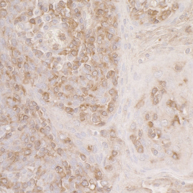 ACTR2/ARP2 Antibody in Immunohistochemistry (Paraffin) (IHC (P))