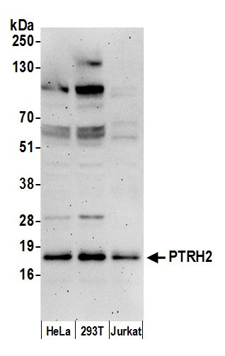 PTRH2/BIT1 Antibody in Western Blot (WB)