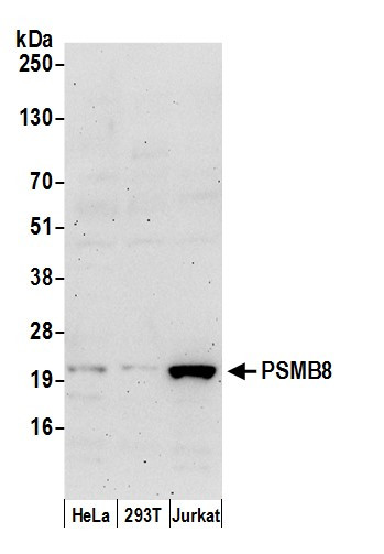 PSMB8/LMP7 Antibody in Western Blot (WB)