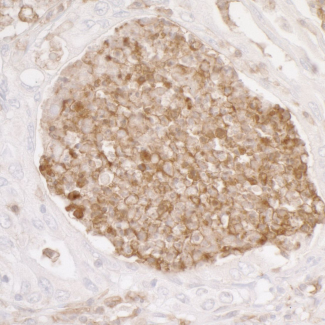 ANXA1/Annexin A1 Antibody in Immunohistochemistry (Paraffin) (IHC (P))