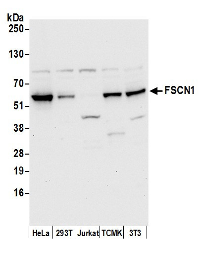 FSCN1 Antibody in Western Blot (WB)