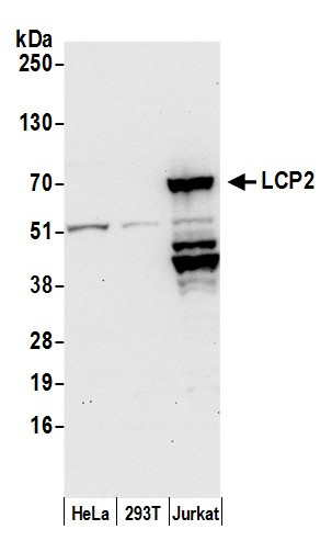 LCP2/SLP76 Antibody in Western Blot (WB)