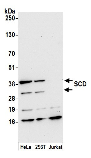 SCD/SCD1/Stearoyl-CoA Desaturase Antibody in Western Blot (WB)
