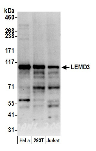 LEMD3/MAN1 Antibody in Western Blot (WB)