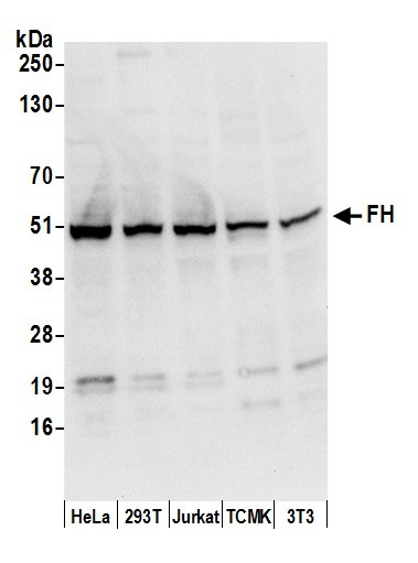 FH/Fumarate Hydratase Antibody in Western Blot (WB)
