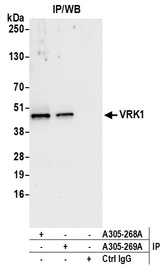 VRK1 Antibody in Immunoprecipitation (IP)