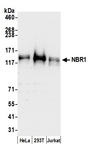 NBR1 Antibody in Western Blot (WB)