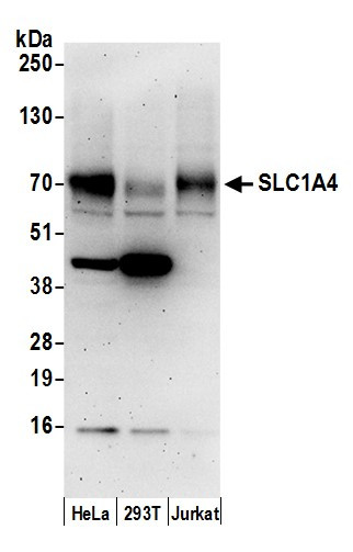 SLC1A4/ASCT1 Antibody in Western Blot (WB)