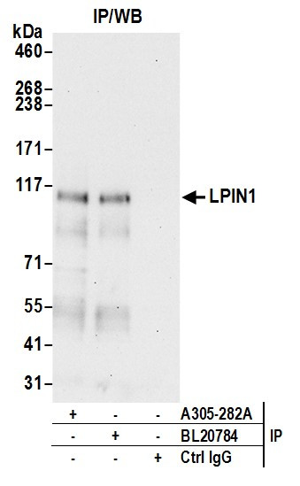 LPIN1 Antibody in Immunoprecipitation (IP)
