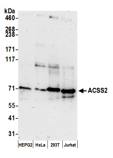 ACSS2/ACS Antibody in Western Blot (WB)