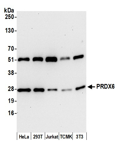 PRDX6 Antibody in Western Blot (WB)