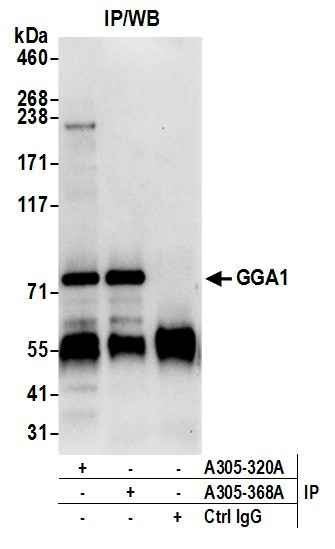 GGA1 Antibody in Immunoprecipitation (IP)