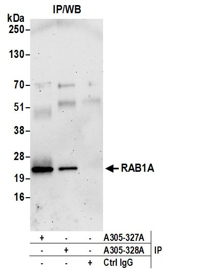 RAB1A Antibody in Immunoprecipitation (IP)