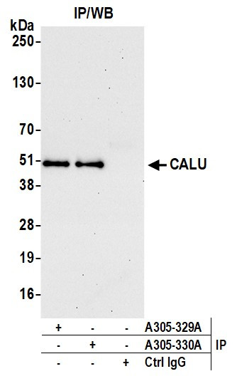 CALU Antibody in Immunoprecipitation (IP)
