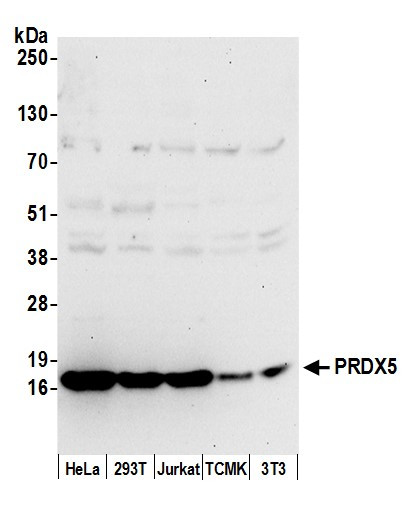 PRDX5 Antibody in Western Blot (WB)