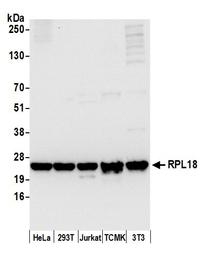 RPL18/Ribosomal Protein L18 Antibody in Western Blot (WB)