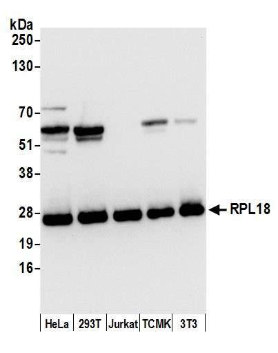 RPL18/Ribosomal Protein L18 Antibody in Western Blot (WB)
