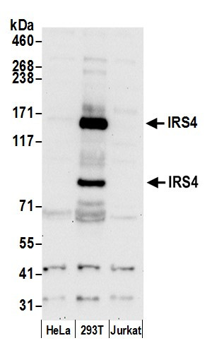 IRS4 Antibody in Western Blot (WB)