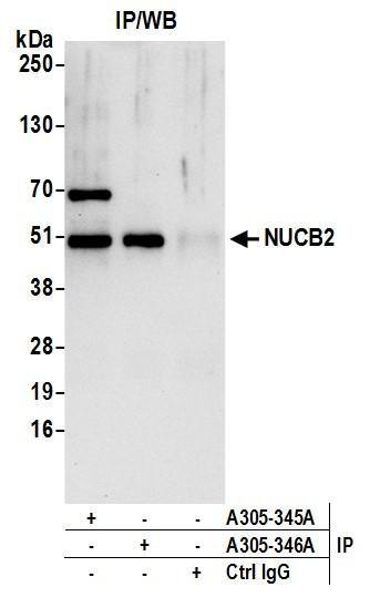 NUCB2 Antibody in Immunoprecipitation (IP)
