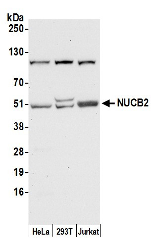 NUCB2 Antibody in Western Blot (WB)