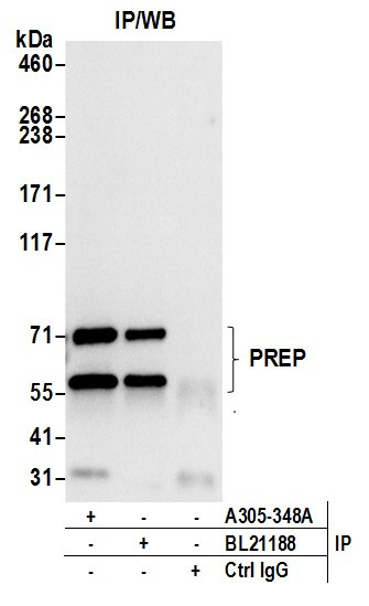 PREP/Prolyl Oligopeptidase Antibody in Immunoprecipitation (IP)