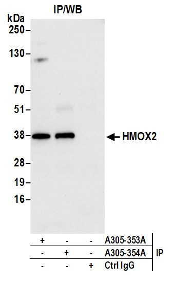 HMOX2 Antibody in Immunoprecipitation (IP)