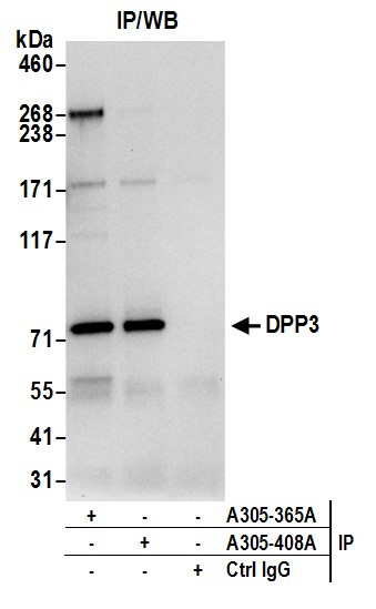DPP3 Antibody in Immunoprecipitation (IP)