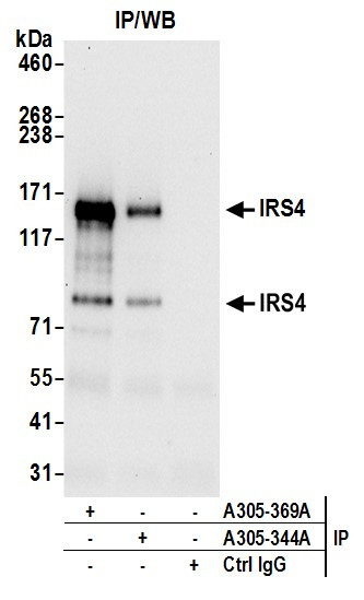 IRS4 Antibody in Immunoprecipitation (IP)