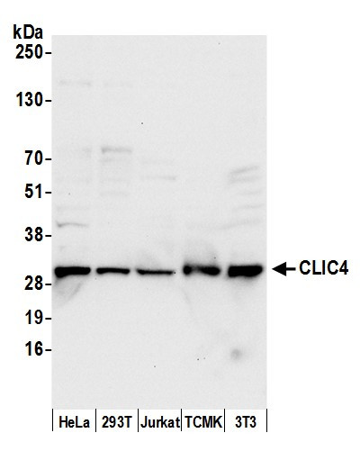 CLIC4 Antibody in Western Blot (WB)
