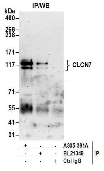 CLCN7 Antibody in Immunoprecipitation (IP)