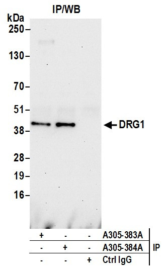 DRG1 Antibody in Immunoprecipitation (IP)