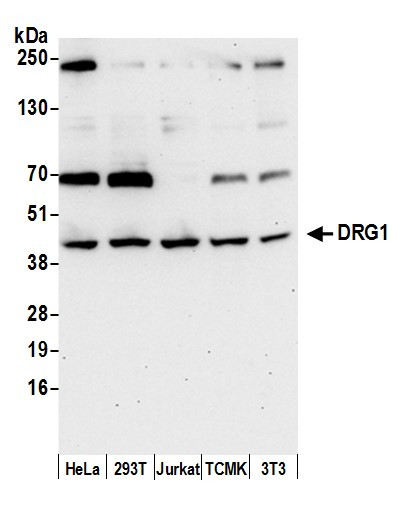 DRG1 Antibody in Western Blot (WB)