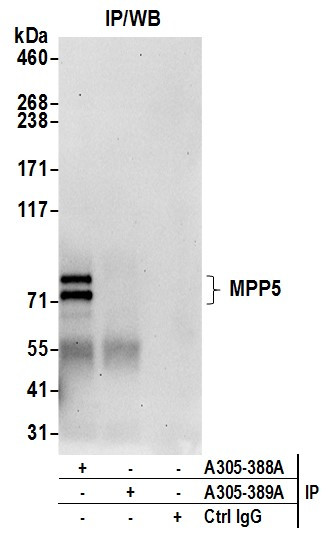MPP5/Pals1 Antibody in Immunoprecipitation (IP)