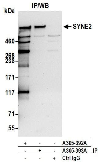 SYNE2/Nesprin 2 Antibody in Immunoprecipitation (IP)