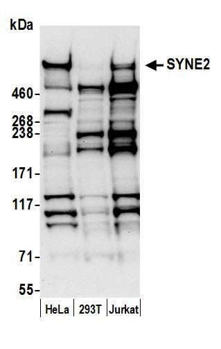 SYNE2/Nesprin 2 Antibody in Western Blot (WB)