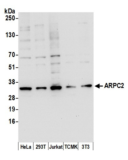 ARPC2 Antibody in Western Blot (WB)