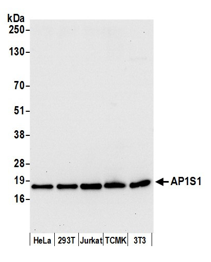 AP1S1 Antibody in Western Blot (WB)