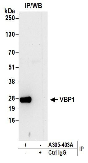 VBP1 Antibody in Immunoprecipitation (IP)