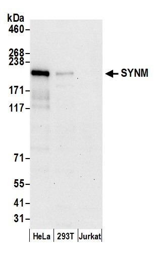 SYNM Antibody in Western Blot (WB)