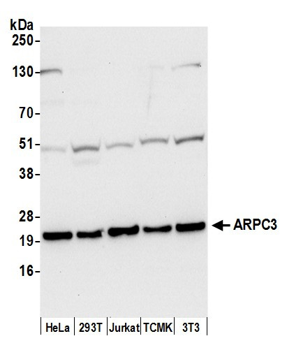 ARPC3 Antibody in Western Blot (WB)
