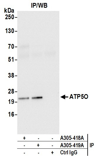 ATP5O Antibody in Immunoprecipitation (IP)