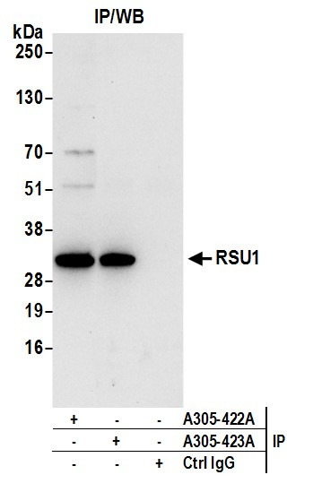 RSU1 Antibody in Immunoprecipitation (IP)