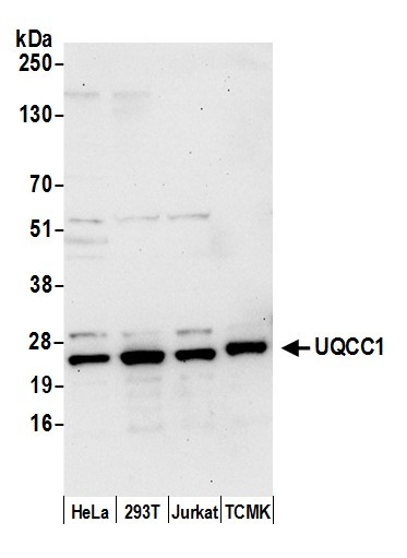 UQCC1 Antibody in Western Blot (WB)