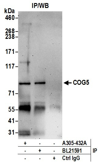 COG5 Antibody in Immunoprecipitation (IP)
