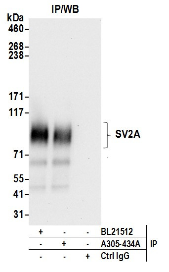 SV2A/SV2 Antibody in Immunoprecipitation (IP)