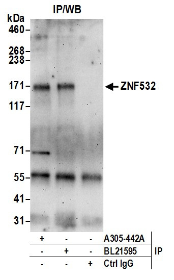 ZNF532 Antibody in Immunoprecipitation (IP)