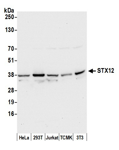 STX12 Antibody in Western Blot (WB)