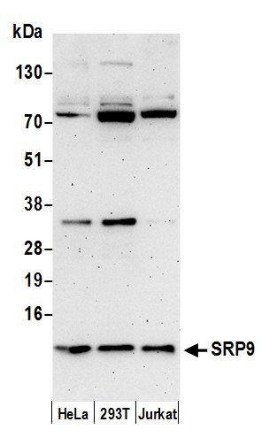 SRP9 Antibody in Western Blot (WB)